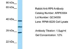 Image no. 1 for anti-Retinitis Pigmentosa 9 (Autosomal Dominant) (RP9) (C-Term) antibody (ABIN2789660)