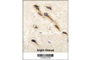 Immunohistochemistry (IHC) image for anti-Cytochrome P450, Family 26, Subfamily B, Polypeptide 1 (CYP26B1) antibody (ABIN2158440)