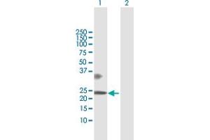 Image no. 2 for anti-Betacellulin (BTC) (AA 1-178) antibody (ABIN513827)