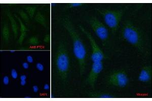 Image no. 2 for anti-Patched 1 (PTCH1) (C-Term) antibody (ABIN185521)
