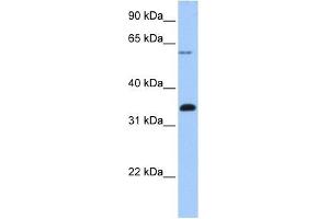 Image no. 1 for anti-F-Box Protein 16 (FBXO16) (C-Term) antibody (ABIN632356)