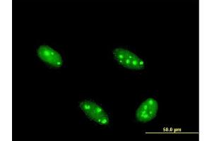 Image no. 2 for anti-Nuclear Factor I/A (NFIA) (AA 1-498) antibody (ABIN518309)