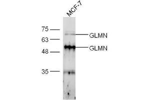 Image no. 1 for anti-Glomulin, FKBP Associated Protein (GLMN) (AA 151-250) antibody (ABIN721945)