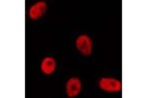 Image no. 3 for anti-Transcription Factor AP-2 gamma (Activating Enhancer Binding Protein 2 Gamma) (TFAP2C) antibody (ABIN6265533)