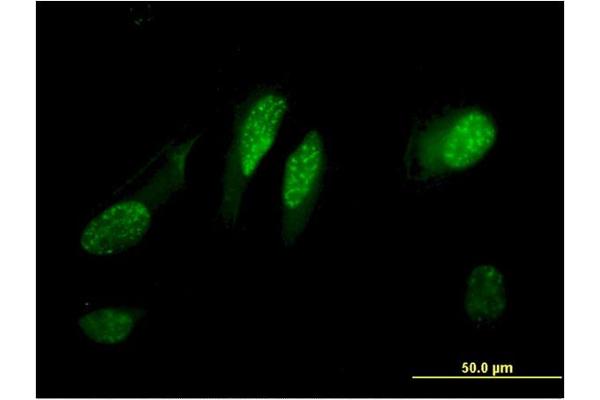 anti-Chromosome 13 Open Reading Frame 15 (C13orf15) (AA 1-117) antibody