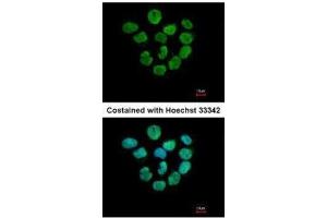 Image no. 5 for anti-H2A Histone Family, Member Z (H2AFZ) (C-Term) antibody (ABIN2856585)