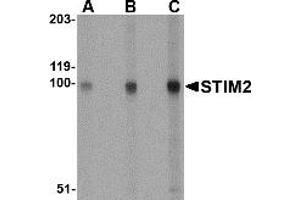 Image no. 1 for anti-Stromal Interaction Molecule 2 (Stim2) (Middle Region) antibody (ABIN1031110)