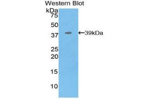Image no. 1 for anti-Myelin Basic Protein (MBP) antibody (Biotin) (ABIN1173055)