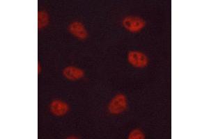 Image no. 1 for anti-FBJ Murine Osteosarcoma Viral Oncogene Homolog B (FOSB) antibody (ABIN6261784)