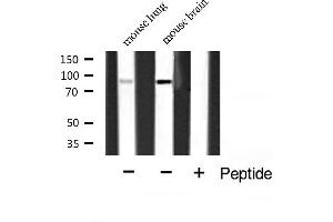 Image no. 1 for anti-ATP-Binding Cassette, Sub-Family F (GCN20), Member 1 (ABCF1) (C-Term) antibody (ABIN6257922)