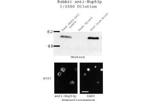Image no. 1 for anti-Nucleoporin 35kDa (NUP35) antibody (ABIN108656)