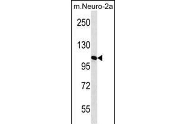 MAN2A2 anticorps  (AA 767-796)