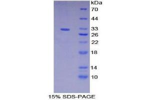 Image no. 1 for Meprin A, alpha (PABA Peptide Hydrolase) (MEP1A) (AA 219-463) protein (His tag) (ABIN1879557)