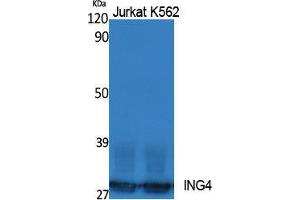 Image no. 1 for anti-Inhibitor of Growth Family, Member 4 (ING4) (Internal Region) antibody (ABIN3187605)