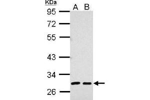 WB Image Sample (30 ug of whole cell lysate) A: 293T B: A431 10% SDS PAGE antibody diluted at 1:5000