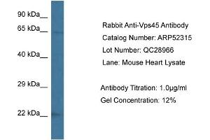 Image no. 1 for anti-Vacuolar Protein Sorting 45 (VPS45) (C-Term) antibody (ABIN2784878)