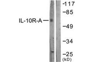 Image no. 1 for anti-Interleukin 10 Receptor, alpha (IL10RA) (AA 462-511) antibody (ABIN1532686)