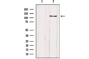 Image no. 3 for anti-Dishevelled Associated Activator of Morphogenesis 1 (DAAM1) (Internal Region) antibody (ABIN6261212)