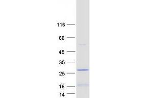 LIN52 Protein (Lin-52 Homolog) (Myc-DYKDDDDK Tag)