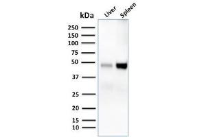 Image no. 1 for anti-CD209 (CD209) antibody (ABIN6939610)