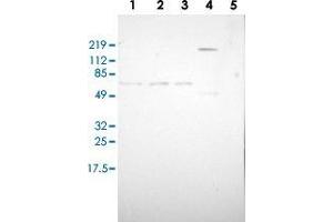 Image no. 2 for anti-Zinc Finger and BTB Domain Containing 16 (ZBTB16) antibody (ABIN5591135)