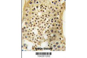 Image no. 2 for anti-Ubiquitin Specific Peptidase 7 (Herpes Virus-Associated) (USP7) (AA 1060-1090), (C-Term) antibody (ABIN388889)