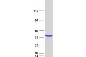 Image no. 1 for Citrate Lyase beta Like (CLYBL) protein (Myc-DYKDDDDK Tag) (ABIN2712892)