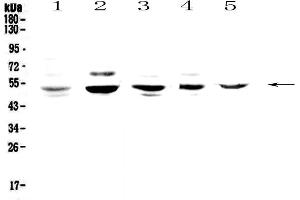 Image no. 1 for anti-Nuclear Factor I/B (NFIB) antibody (ABIN5692906)