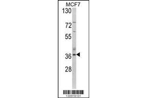 Image no. 1 for anti-Aspartoacylase (ASPA) (AA 82-110), (N-Term) antibody (ABIN390843)