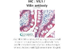 Image no. 1 for anti-Villin-Like (VILL) antibody (ABIN1724348)