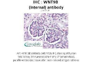Image no. 1 for anti-Wingless-Type MMTV Integration Site Family, Member 9B (WNT9B) (Internal Region) antibody (ABIN1740845)