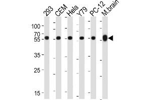Image no. 3 for anti-Tubulin, beta (TUBB) antibody (ABIN387758)