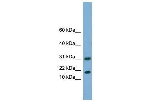 Image no. 1 for anti-Eukaryotic Translation Initiation Factor 5A2 (EIF5A2) (N-Term) antibody (ABIN632450)