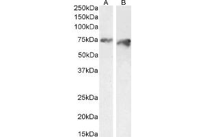Image no. 3 for anti-Proprotein Convertase Subtilisin/kexin Type 9 (PCSK9) (AA 214-228) antibody (ABIN570954)