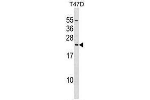 anti-Eukaryotic Translation Initiation Factor 3 Subunit K (EIF3K) (AA 175-204), (C-Term) antibody