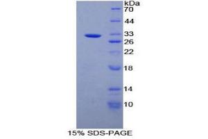 Image no. 1 for Alanine Aminotransferase (ALT) (AA 290-533) protein (His tag) (ABIN1879585)