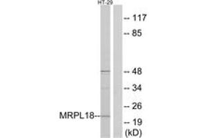 Image no. 1 for anti-Mitochondrial Ribosomal Protein L18 (MRPL18) (AA 1-50) antibody (ABIN1534522)