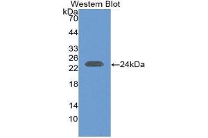 Image no. 1 for anti-Interleukin 29 (IL29) (AA 20-200) antibody (ABIN1868653)
