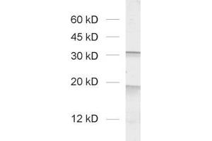 Image no. 1 for anti-VAMP (Vesicle-Associated Membrane Protein)-Associated Protein A, 33kDa (VAPA) (AA 1-223) antibody (ABIN1742504)