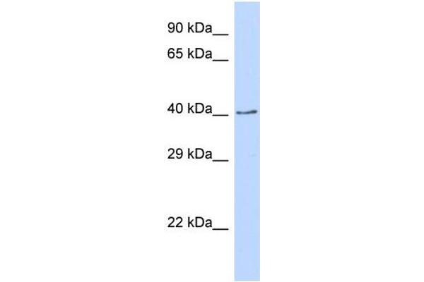 anti-CDP-Diacylglycerol Synthase (Phosphatidate Cytidylyltransferase) 2 (CDS2) (C-Term) antibody
