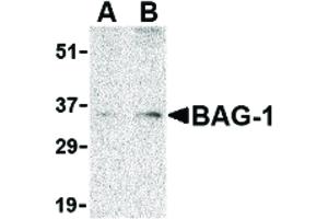 Image no. 1 for anti-BCL2-Associated Athanogene (BAG1) (N-Term) antibody (ABIN6656638)