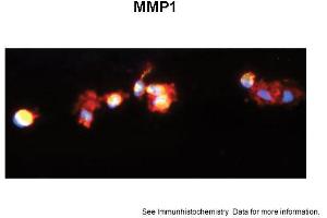 Image no. 1 for anti-Matrix Metallopeptidase 1 (Interstitial Collagenase) (MMP1) (C-Term) antibody (ABIN2777120)