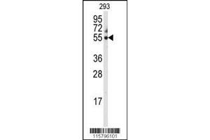 Image no. 1 for anti-Cytochrome P450, Family 3, Subfamily A, Polypeptide 5 (CYP3A5) (AA 476-502), (C-Term) antibody (ABIN392224)