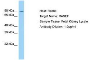 Image no. 1 for anti-RAS and EF Hand Domain Containing (RASEF) (AA 194-243) antibody (ABIN6750067)