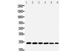 Image no. 1 for anti-Synaptosomal-Associated Protein, 23kDa (SNAP23) (AA 192-211), (C-Term) antibody (ABIN3044163)