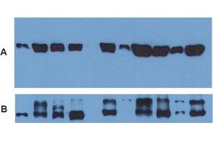 Image no. 4 for anti-Tubulin, alpha 1B (TUBA1B) antibody (ABIN535450)