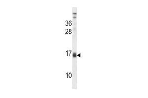 Image no. 2 for anti-Lactalbumin, alpha- (LALBA) (AA 37-68), (Center) antibody (ABIN2489104)