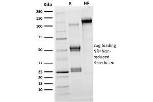 Image no. 1 for anti-Oligodendrocyte Lineage Transcription Factor 2 (OLIG2) (AA 1-141) antibody (ABIN6939031)