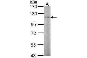 Image no. 1 for anti-Retinoblastoma Binding Protein 8 (RBBP8) (Center) antibody (ABIN2856639)