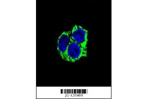 Image no. 2 for anti-Coenzyme Q8A (COQ8A) antibody (ABIN659101)